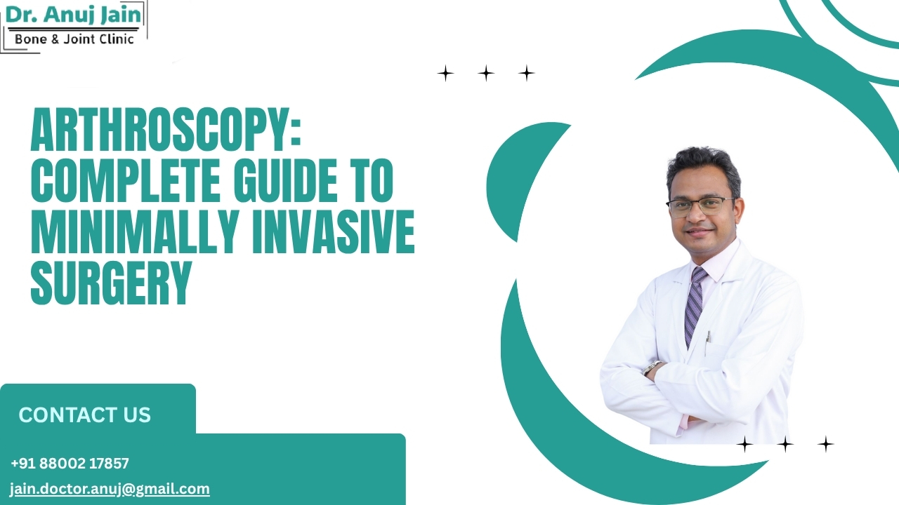  Arthroscopic surgery in Noida

